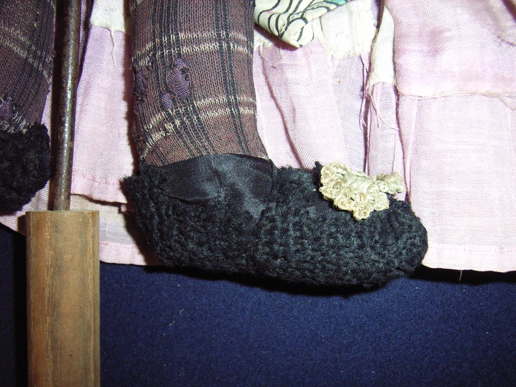 Gamba destra dopo il restauro